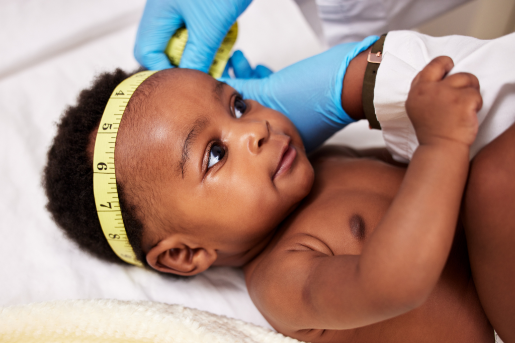 Infant with measuring tape on head